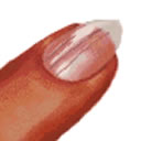 Stries longitudinales